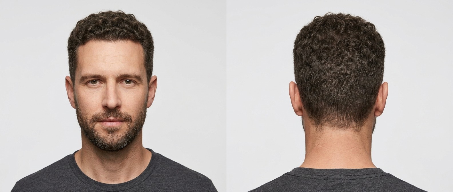 Front and back view of a 45-year-old man with a modified curly induction cut, tapered sides, and a short beard, showcasing natural Type 3 curls.