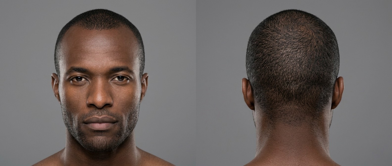 Front and back view of a Black man with an ultra-short induction buzz cut, natural hairline, and light facial stubble on a gray background.